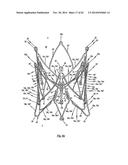 STENT FOR THE POSITIONING AND ANCHORING OF A VALVULAR PROSTHESIS IN AN     IMPLANTATION SITE IN THE HEART OF A PATIENT diagram and image