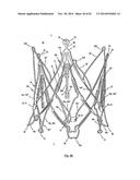 STENT FOR THE POSITIONING AND ANCHORING OF A VALVULAR PROSTHESIS IN AN     IMPLANTATION SITE IN THE HEART OF A PATIENT diagram and image