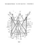 STENT FOR THE POSITIONING AND ANCHORING OF A VALVULAR PROSTHESIS IN AN     IMPLANTATION SITE IN THE HEART OF A PATIENT diagram and image