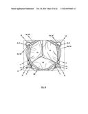 STENT FOR THE POSITIONING AND ANCHORING OF A VALVULAR PROSTHESIS IN AN     IMPLANTATION SITE IN THE HEART OF A PATIENT diagram and image