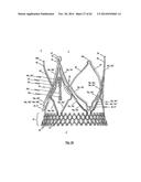 STENT FOR THE POSITIONING AND ANCHORING OF A VALVULAR PROSTHESIS IN AN     IMPLANTATION SITE IN THE HEART OF A PATIENT diagram and image