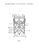 STENT FOR THE POSITIONING AND ANCHORING OF A VALVULAR PROSTHESIS IN AN     IMPLANTATION SITE IN THE HEART OF A PATIENT diagram and image