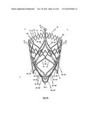 STENT FOR THE POSITIONING AND ANCHORING OF A VALVULAR PROSTHESIS IN AN     IMPLANTATION SITE IN THE HEART OF A PATIENT diagram and image