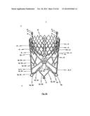 STENT FOR THE POSITIONING AND ANCHORING OF A VALVULAR PROSTHESIS IN AN     IMPLANTATION SITE IN THE HEART OF A PATIENT diagram and image