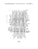 STENT FOR THE POSITIONING AND ANCHORING OF A VALVULAR PROSTHESIS IN AN     IMPLANTATION SITE IN THE HEART OF A PATIENT diagram and image