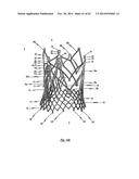 STENT FOR THE POSITIONING AND ANCHORING OF A VALVULAR PROSTHESIS IN AN     IMPLANTATION SITE IN THE HEART OF A PATIENT diagram and image