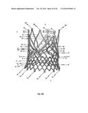 STENT FOR THE POSITIONING AND ANCHORING OF A VALVULAR PROSTHESIS IN AN     IMPLANTATION SITE IN THE HEART OF A PATIENT diagram and image