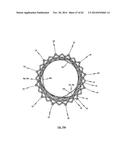 STENT FOR THE POSITIONING AND ANCHORING OF A VALVULAR PROSTHESIS IN AN     IMPLANTATION SITE IN THE HEART OF A PATIENT diagram and image