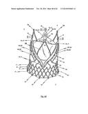 STENT FOR THE POSITIONING AND ANCHORING OF A VALVULAR PROSTHESIS IN AN     IMPLANTATION SITE IN THE HEART OF A PATIENT diagram and image