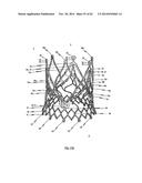 STENT FOR THE POSITIONING AND ANCHORING OF A VALVULAR PROSTHESIS IN AN     IMPLANTATION SITE IN THE HEART OF A PATIENT diagram and image