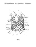 STENT FOR THE POSITIONING AND ANCHORING OF A VALVULAR PROSTHESIS IN AN     IMPLANTATION SITE IN THE HEART OF A PATIENT diagram and image