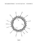 STENT FOR THE POSITIONING AND ANCHORING OF A VALVULAR PROSTHESIS IN AN     IMPLANTATION SITE IN THE HEART OF A PATIENT diagram and image