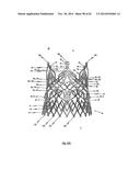 STENT FOR THE POSITIONING AND ANCHORING OF A VALVULAR PROSTHESIS IN AN     IMPLANTATION SITE IN THE HEART OF A PATIENT diagram and image