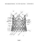 STENT FOR THE POSITIONING AND ANCHORING OF A VALVULAR PROSTHESIS IN AN     IMPLANTATION SITE IN THE HEART OF A PATIENT diagram and image