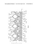 STENT FOR THE POSITIONING AND ANCHORING OF A VALVULAR PROSTHESIS IN AN     IMPLANTATION SITE IN THE HEART OF A PATIENT diagram and image