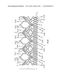 STENT FOR THE POSITIONING AND ANCHORING OF A VALVULAR PROSTHESIS IN AN     IMPLANTATION SITE IN THE HEART OF A PATIENT diagram and image