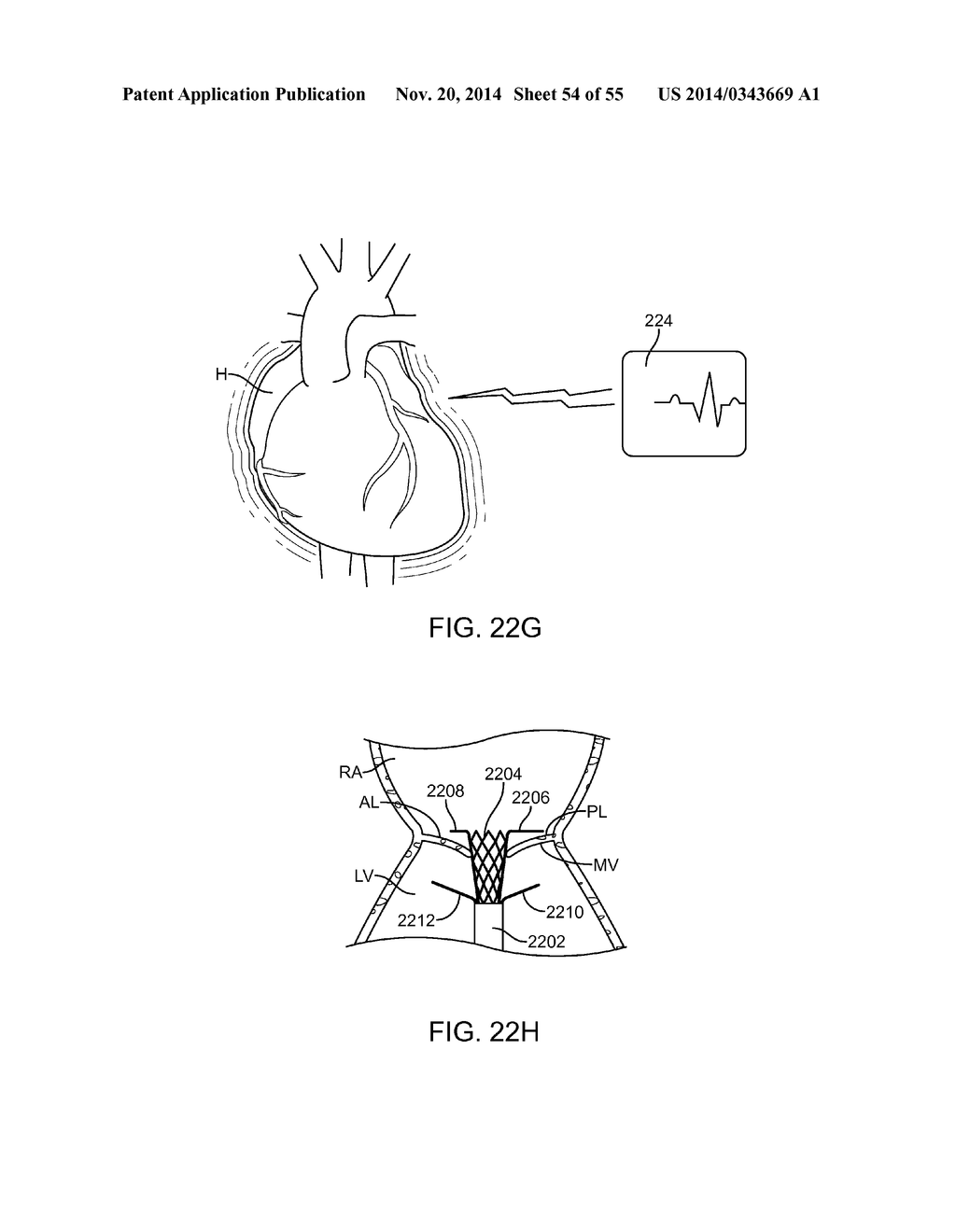 METHODS AND APPARATUS FOR DELIVERING A PROSTHETIC VALVE TO A BEATING HEART - diagram, schematic, and image 55