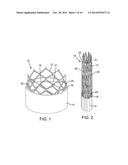 PERIVALVULAR SEALING FOR TRANSCATHETER HEART VALVE diagram and image