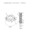 PERIVALVULAR SEALING FOR TRANSCATHETER HEART VALVE diagram and image