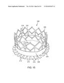 PERIVALVULAR SEALING FOR TRANSCATHETER HEART VALVE diagram and image