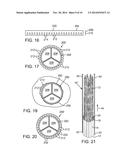 PERIVALVULAR SEALING FOR TRANSCATHETER HEART VALVE diagram and image