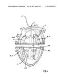 ARTIFICIAL HEART diagram and image