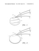 Extracellular Matrix Encasement Structures and Methods diagram and image