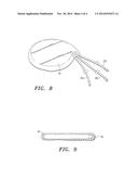 Extracellular Matrix Encasement Structures and Methods diagram and image