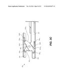 Intervertebral devices and related methods diagram and image