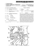 DISC-FACET VERTEBRAL DEVICE diagram and image