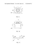 DISC-FACET VERTEBRAL DEVICE diagram and image