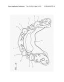 PROSTHODONTIC DEVICE diagram and image