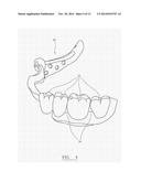 PROSTHODONTIC DEVICE diagram and image