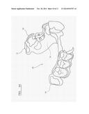 PROSTHODONTIC DEVICE diagram and image