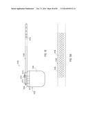 TERMINATION OF A SHIELD WITHIN AN IMPLANTABLE MEDICAL LEAD diagram and image