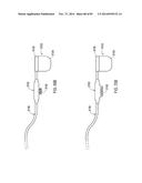 TERMINATION OF A SHIELD WITHIN AN IMPLANTABLE MEDICAL LEAD diagram and image