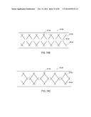 TERMINATION OF A SHIELD WITHIN AN IMPLANTABLE MEDICAL LEAD diagram and image