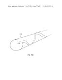 TERMINATION OF A SHIELD WITHIN AN IMPLANTABLE MEDICAL LEAD diagram and image