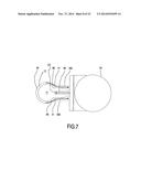 REMOVAL DEVICE diagram and image