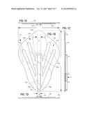 METHOD AND APPARATUS FOR ASSISTING IN WOUND CLOSURE diagram and image