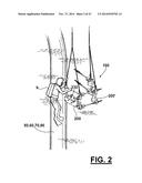 METHOD AND APPARATUS OF HOT TAPPING MULTIPLE COAXIAL OR NESTED STRINGS OF     UNDERWATER PIPING AND/OR TUBING FOR OVERTURNED WELLS OR PLATFORMS diagram and image