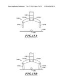 KINETIC AND DIMENSIONAL OPTIMIZATION FOR A TENDON-DRIVEN GRIPPER diagram and image