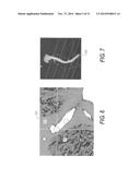 METHOD AND SYSTEM FOR PATIENT-SPECIFIC MODELING OF BLOOD FLOW diagram and image