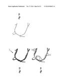 METHOD AND SYSTEM FOR PATIENT-SPECIFIC MODELING OF BLOOD FLOW diagram and image