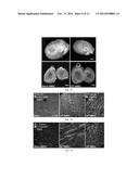 COMPOSITIONS AND METHODS FOR USING CELLS TO TREAT HEART TISSUE diagram and image