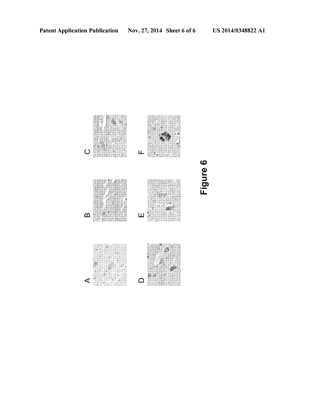 Methods and Compositions to Treat and Detect Misfolded-SOD1 Mediated     DIseases - diagram, schematic, and image 07