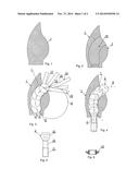 CHANNEL FORMATION FOR THE FIXING ELEMENT OF A DENTAL SUPERSTRUCTURE AND     METHOD OF MAKING THE SAME diagram and image