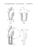 CHANNEL FORMATION FOR THE FIXING ELEMENT OF A DENTAL SUPERSTRUCTURE AND     METHOD OF MAKING THE SAME diagram and image