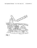 METHOD OF COLLECTING PLACENTAL STEM CELLS diagram and image