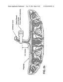 METHOD OF COLLECTING PLACENTAL STEM CELLS diagram and image
